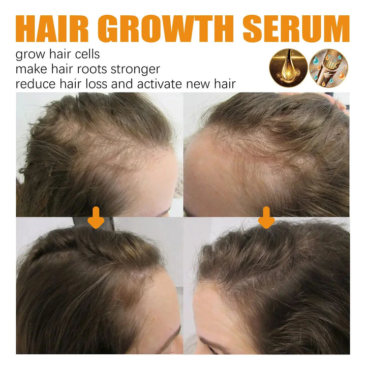 Biotin EELHOE Fast Hair Growth